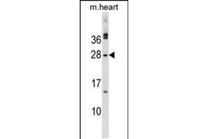 Western blot analysis in mouse heart tissue lysates (35ug/lane). (Musculin 抗体  (C-Term))