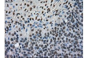 Immunohistochemistry (IHC) image for anti-Antigen Identified By Monoclonal Antibody Ki-67 (MKI67) (AA 1-250) antibody (ABIN2724155)
