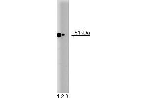 Western Blotting (WB) image for anti-Calcineurin (CAN) (AA 247-449) antibody (ABIN967861) (CAN 抗体  (AA 247-449))