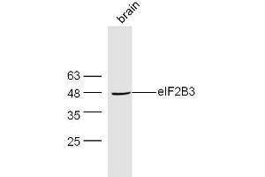 Mouse brain lysates probed with Rabbit Anti-EIF2B3 Polyclonal Antibody, Unconjugated  at 1:300 overnight at 4˚C. (EIF2B3 抗体  (AA 101-200))
