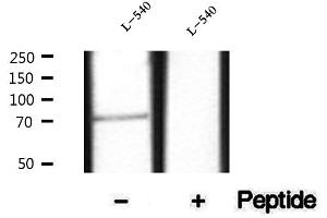 anti-Tyrosine Kinase, Non-Receptor, 1 (TNK1) (pTyr277) antibody