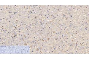 Immunohistochemistry of paraffin-embedded Mouse brain tissue using CD4 Monoclonal Antibody at dilution of 1:200. (CD4 抗体)