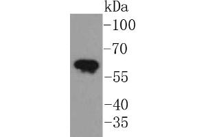 A431 lysates, probed with Cytokeratin 5 (2H5) Monoclonal Antibody  at 1:1000 overnight at 4˚C. (Cytokeratin 5 抗体)