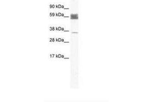 Image no. 1 for anti-Zinc Finger Protein 713 (ZNF713) (AA 118-167) antibody (ABIN202504) (ZNF713 抗体  (AA 118-167))