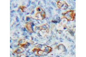 Used in DAB staining on fromalin fixed paraffin-embedded Ovary tissue (FSHR 抗体  (AA 18-113))