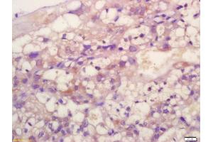 Formalin-fixed and paraffin embedded mouse placenta labeled with Anti-TIMP-2 Polyclonal Antibody, Unconjugated (ABIN1713918) at 1:200 followed by conjugation to the secondary antibody and DAB staining (TIMP2 抗体  (AA 51-150))