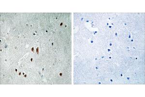P-peptide - + (CNOT2 抗体  (pSer101))