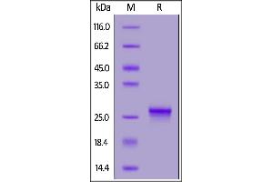 Biotinylated Human IL-17C, His,Avitag on  under reducing (R) condition. (IL17C Protein (AA 19-197) (His tag,AVI tag,Biotin))