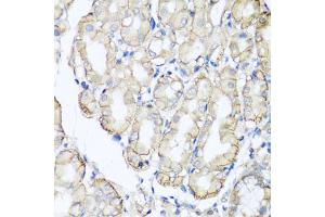 Immunohistochemistry of paraffin-embedded human stomach using AHCYL1 antibody (ABIN5975313) at dilution of 1/100 (40x lens). (AHCYL1 抗体)