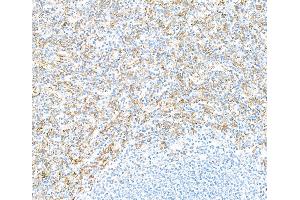 Immunohistochemistry (IHC) image for anti-Fc Fragment of IgG, Low Affinity IIIa, Receptor (CD16a) (FCGR3A) (AA 204-254) antibody (ABIN7449424)