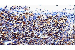 Immunohistochemistry of paraffin-embedded Human tosil tissue using IL10RA Polyclonal Antibody at dilution 1:60 (IL-10RA 抗体)