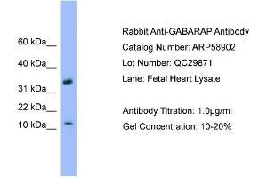 WB Suggested Anti-GABARAP  Antibody Titration: 0. (GABARAP 抗体  (C-Term))