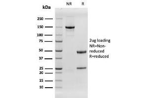 SDS-PAGE Analysis Purified EGFR Recombinant Mouse Monoclonal Antibody (rGFR/1667). (Recombinant EGFR 抗体)