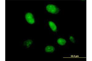 Immunofluorescence of purified MaxPab antibody to CXorf43 on HeLa cell. (HDX 抗体  (AA 1-690))