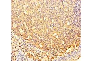 Immunohistochemistry of paraffin-embedded human tonsil tissue using ABIN7148034 at dilution of 1:100 (CBWD2 抗体  (AA 96-395))
