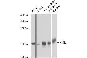 Western blot analysis of extracts of various cell lines using NME2 Polyclonal Antibody at dilution of 1:1000. (NME2 抗体)