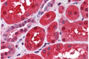 Human Kidney: Formalin-Fixed, Paraffin-Embedded (FFPE) (CLIC1 抗体  (AA 1-242))