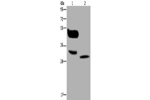 Western Blotting (WB) image for anti-Melanoma Antigen Family A, 8 (MAGEA8) antibody (ABIN2423755) (MAGEA8 抗体)