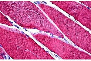 Human Skeletal Muscle: Formalin-Fixed, Paraffin-Embedded (FFPE) (TNNC1 抗体)