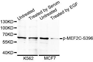 Western blot analysis of extracts from 24 hours starved 3T3 cells using Phospho-MEF2C-S396 antibody. (MEF2C 抗体  (pSer396))