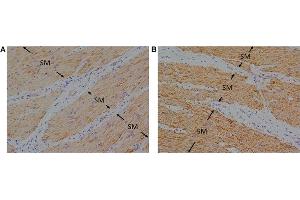 Immunohistochemistry (Paraffin-embedded Sections) (IHC (p)) image for anti-omega-3 Fatty Acid Receptor 1 (O3FAR1) (N-Term) antibody (ABIN2854731)