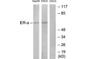 Western blot analysis of extracts from HepG2/COLO cells, treated with EGF, using Estrogen Receptor-alpha (Ab-167) Antibody. (Estrogen Receptor alpha 抗体  (AA 136-185))