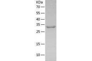Western Blotting (WB) image for Leucine Carboxyl Methyltransferase 1 (LCMT1) (AA 1-334) protein (His tag) (ABIN7123749) (LCMT1 Protein (AA 1-334) (His tag))