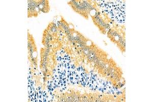 Immunohistochemistry of paraffin embedded rat small intestine using GRASP (ABIN7074140) at dilution of 1:400 (400x lens) (Tamalin/GRASP 抗体)