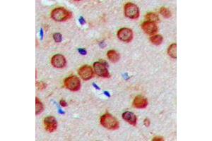 Immunohistochemical analysis of Cadherin 23 staining in human brain formalin fixed paraffin embedded tissue section. (CDH23 抗体  (N-Term))