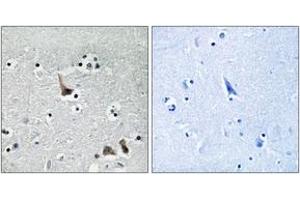 Immunohistochemistry analysis of paraffin-embedded human brain tissue, using ATP6V1H Antibody. (ATP6V1H 抗体  (AA 341-390))