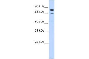 WB Suggested Anti-RMI1 Antibody Titration:  0. (RMI1 抗体  (N-Term))