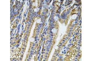 Immunohistochemistry of paraffin-embedded Mouse intestine using NFU1 Polyclonal Antibody at dilution of 1:100 (40x lens). (NFU1 抗体)