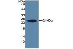Western blot analysis of recombinant Human ARO. (Aromatase 抗体  (AA 196-373))