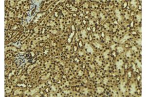 ABIN6277660 at 1/100 staining Mouse kidney tissue by IHC-P. (DCLRE1C 抗体  (C-Term))