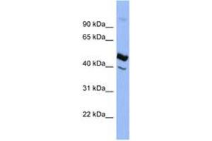 Image no. 1 for anti-serpin Peptidase Inhibitor, Clade D (Heparin Cofactor), Member 1 (SERPIND1) (AA 323-372) antibody (ABIN6741642)