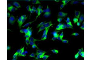 Immunofluorescent staining of undifferentiated (left) and differentiated (right) SH-SY5Y cells. (MAP2 抗体  (AA 19-219))