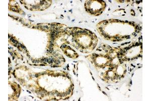 Immunohistochemistry (IHC) image for anti-Peroxiredoxin 6 (PRDX6) (AA 15-224) antibody (ABIN3043358)