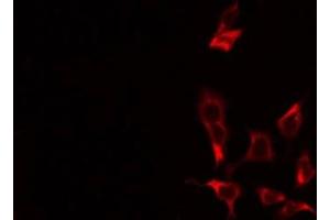 Immunofluorescence (fixed cells) (IF/ICC) image for anti-ATP-Binding Cassette, Sub-Family C (CFTR/MRP), Member 10 (ABCC10) (C-Term) antibody (ABIN6257919)