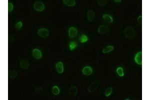 Anti-GSC mouse monoclonal antibody (ABIN2452379) immunofluorescent staining of HeLa cells transiently transfected by pCMV6-ENTRY GSC (RC209586) (GSC 抗体  (AA 107-257))