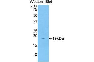 Western Blotting (WB) image for anti-Collagen, Type VIII, alpha 1 (COL8A1) (AA 590-744) antibody (ABIN1175571) (COL8A1 抗体  (AA 590-744))