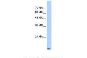Image no. 1 for anti-Transcription Elongation Factor B (SIII), Polypeptide 2 (18kDa, Elongin B) (TCEB2) (C-Term) antibody (ABIN6737644)