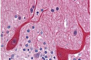Human Brain, Cerebellum: Formalin-Fixed, Paraffin-Embedded (FFPE) (PKDCC 抗体  (Internal Region))