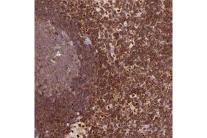 Immunohistochemical staining of human lymph node with DENND1C polyclonal antibody  shows strong cytoplasmic positivity in non-germinal center cells at 1:200-1:500 dilution. (DENND1C 抗体)