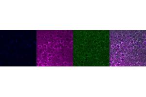 Immunohistochemistry (IHC) image for anti-Insulin-Like Growth Factor Binding Protein 6 (IGFBP6) antibody (ABIN7456037) (IGFBP6 抗体)