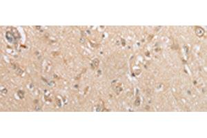Immunohistochemistry of paraffin-embedded Human brain tissue using GCLC Polyclonal Antibody at dilution of 1:35(x200) (GCLC 抗体)