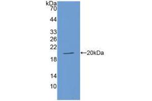 Western blot analysis of recombinant Human ACE. (Angiotensin I Converting Enzyme 1 抗体  (AA 1160-1306))