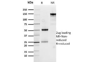 SDS-PAGE Analysis Purified Cathepsin D Mouse Monoclonal Antibody (CTSD/3276).