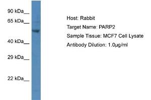 Host:  Rabbit  Target Name:  P Sample Type:  MCF7 Whole Cell lysates  Antibody Dilution:  1. (PARP2 抗体  (C-Term))