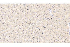 Detection of LIPC in Human Liver Tissue using Polyclonal Antibody to Lipase, Hepatic (LIPC) (LIPC 抗体  (AA 347-478))
