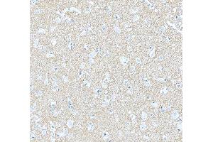 IHC analysis of Septin 3/SEPTIN3 using anti-Septin 3/SEPTIN3 antibody (ABIN7599288).